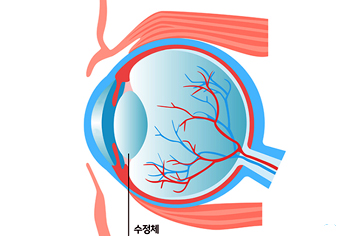 60~70대가 많이 걸리는 ‘백내장’, 젊은 사람도 주의해야
