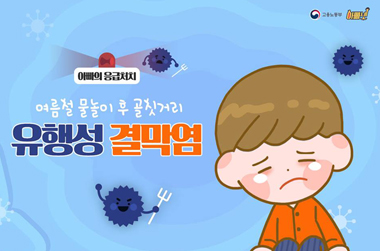 여름철 물놀이 후 골칫거리 ‘유행성 결막염’ 주의