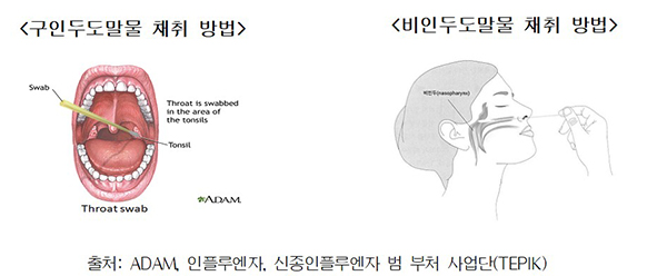 상기도 채취 방법.