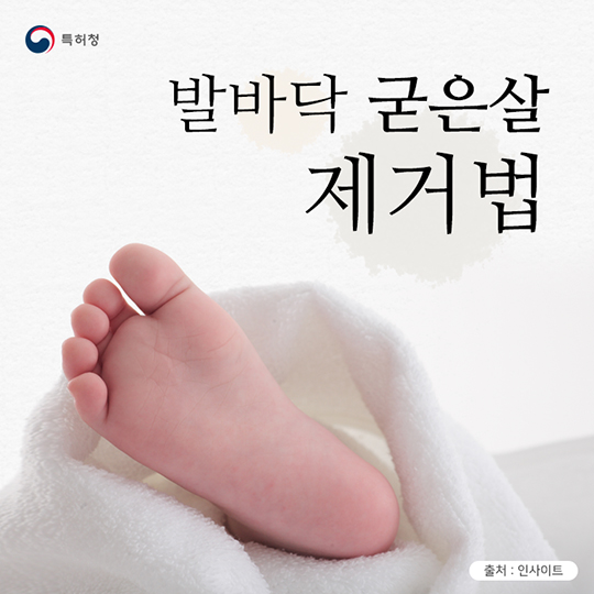 생활발명 꿀팁 발바닥 굳은살 제거법