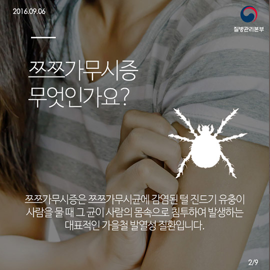 쯔쯔가무시증의 모든것!
