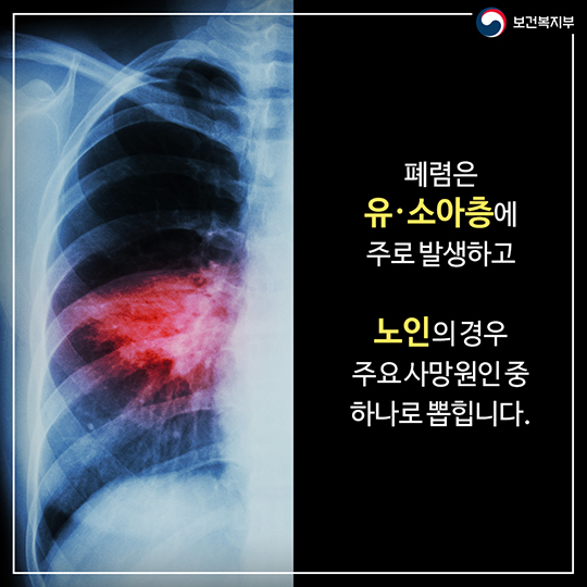지속되는 감기 증상? 폐렴을 의심해보세요!