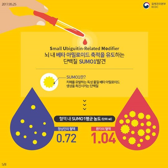 치매 진행을 제어할 수 있는 새로운 물질 발견