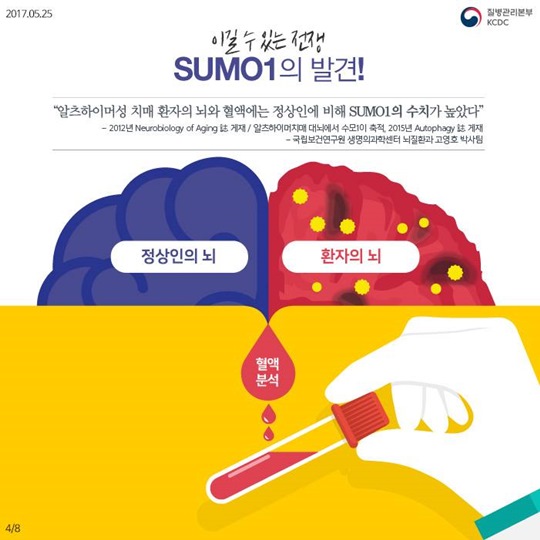 치매 진행을 제어할 수 있는 새로운 물질 발견