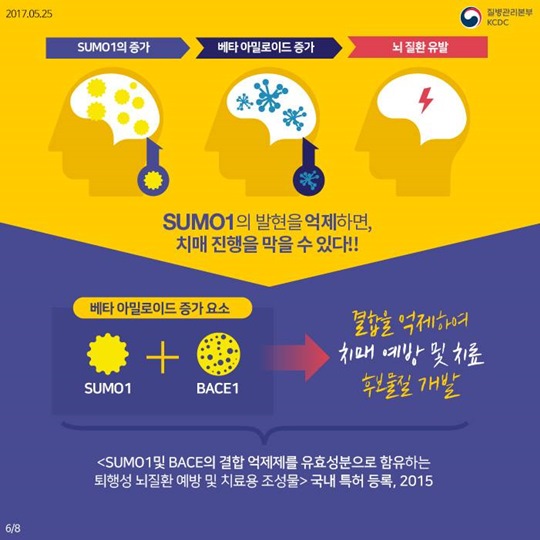 치매 진행을 제어할 수 있는 새로운 물질 발견