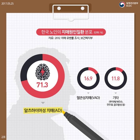 치매 진행을 제어할 수 있는 새로운 물질 발견
