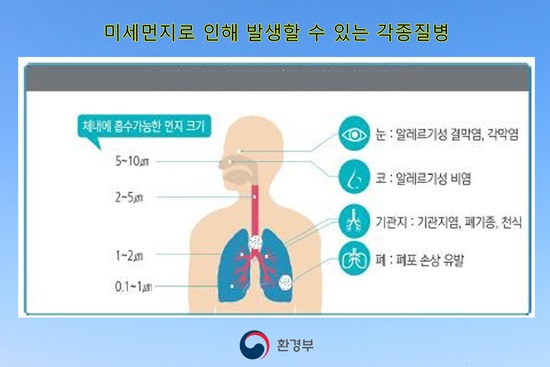 미세먼지로 인해 발생할 수 있는 각종질병