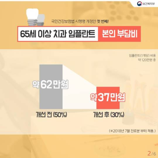 어르신, 임플란트 비용 때문에 걱정 많으셨죠