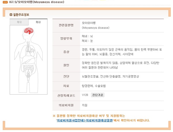 모야모야병.(출처=희귀질환 헬프라인)