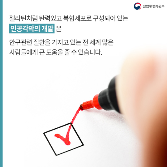 3D 프린터로 인공 각막 개발 성공!