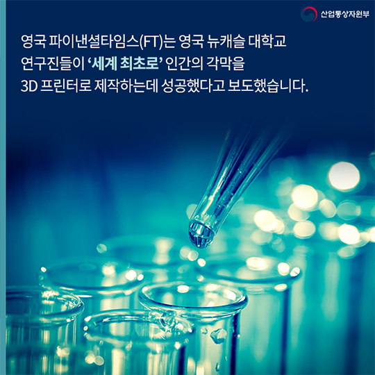 3D 프린터로 인공 각막 개발 성공!