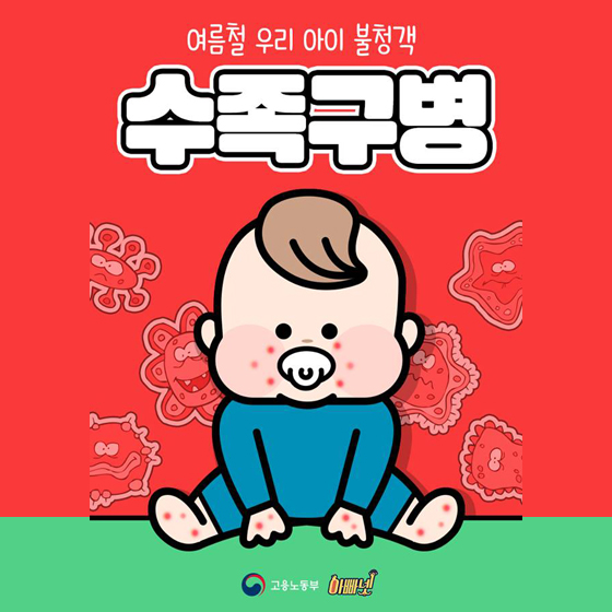 여름철 우리 아이 불청객, 수족구병 관리해요!