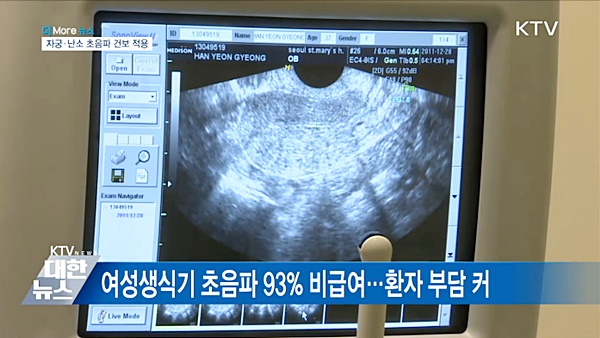 정부는 2월 1일부터 자궁ㆍ난소 등 여성생식기 초음파 검사의 건강보험 적용 범위를 전면 확대하기로 결정했다. (출처=KTV)