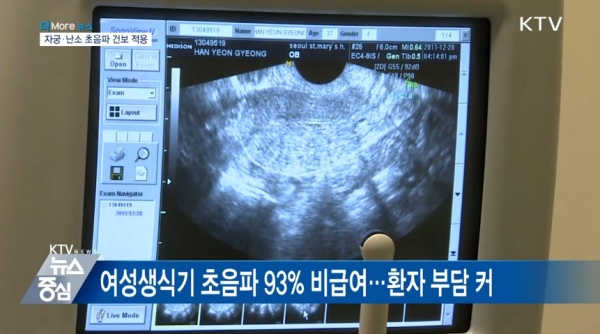 초음파 검사 모습.(출처=KTV)