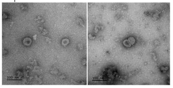 코로나19 바이러스항원(Spike)으로 구성된 바이러스유사체 투과전자현미경 (TEM) 이미지.