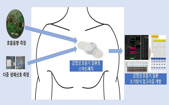 감염성 호흡기 의심자·일반용 스마트 패치와 인공지능 분석 시스템 시안.