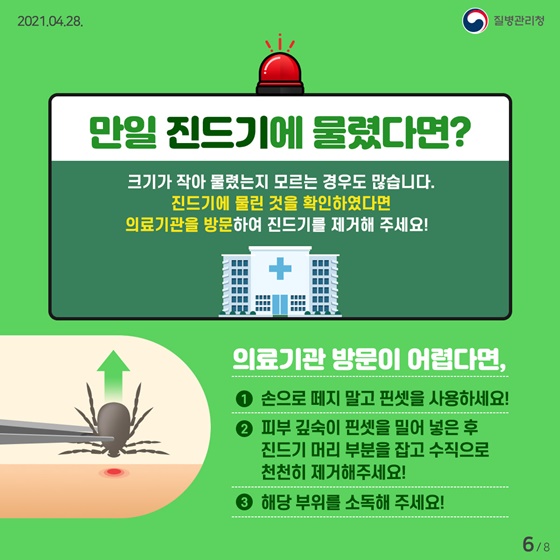 만일 진드기에 물렸다면?