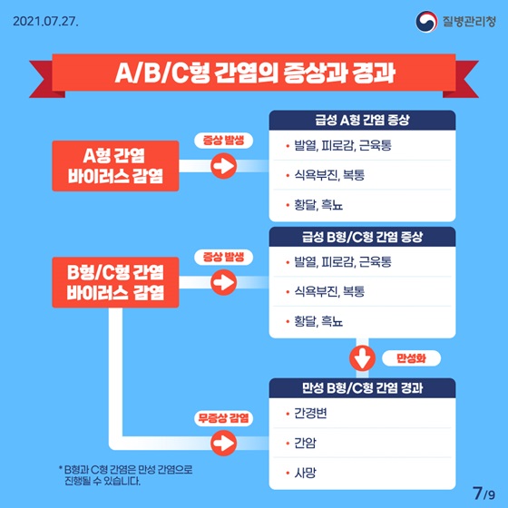 A/B/C형 간염의 증상과 경과