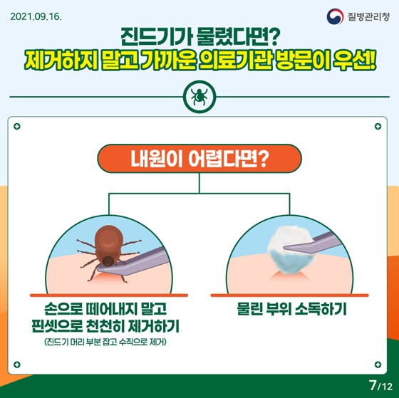 진드기가 물렸다면? 제거하지 말고 가까운 의료기관 방문이 우선!