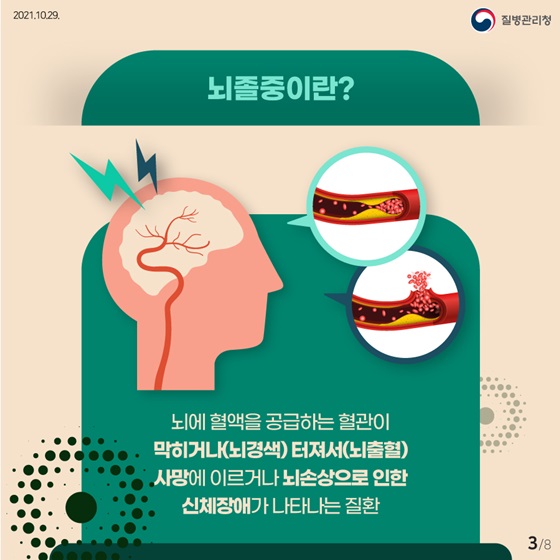 뇌졸중이란?