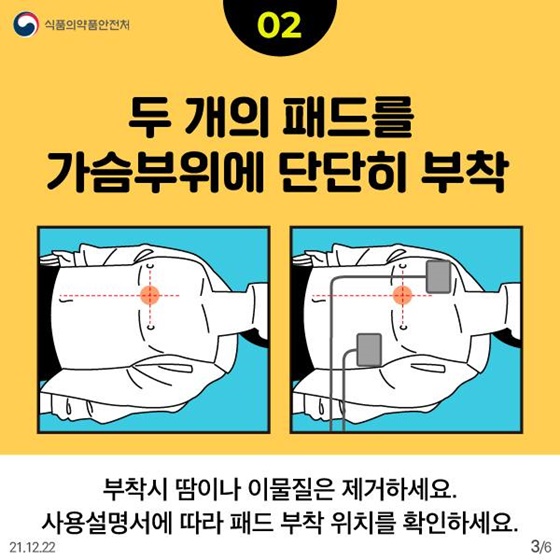 두 개의 패드를 가슴 부위에 단단히 부착