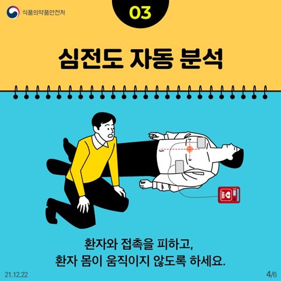 심전도 자동 분석