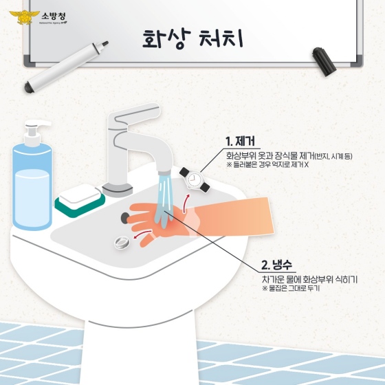 절단상, 화상을 당했을 때 올바른 응급처치