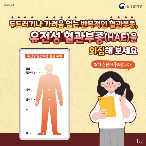 두드러기나 가려움 없는 반복적인 혈관부종, ‘유전성 혈관부종(HAE)’을 의심해 보세요