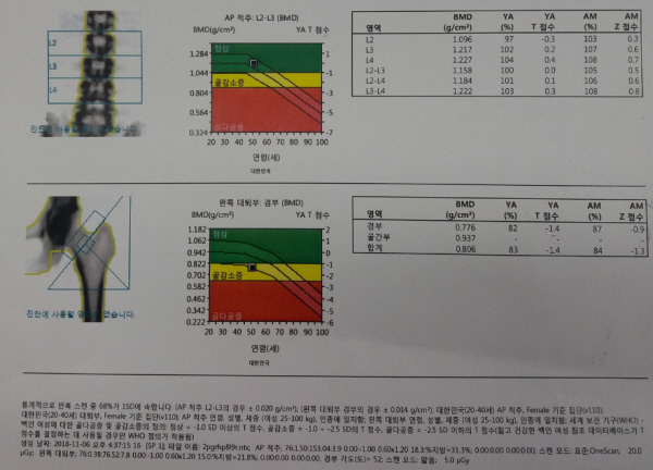 골다공증 검사는 10분 정도 소요되고 결과지를 보고 전문의가 설명을 해주신다.