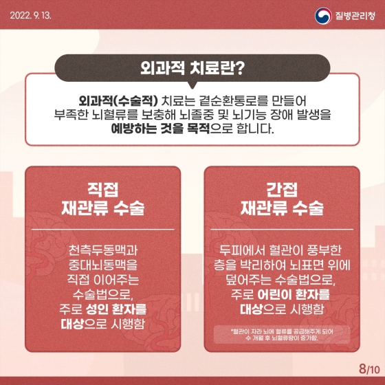 혈관이 연기처럼 모락모락, 모야모야병