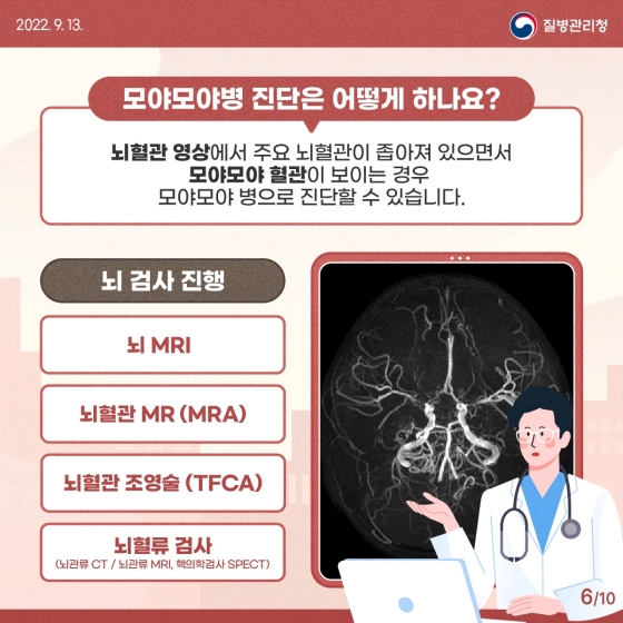 혈관이 연기처럼 모락모락, 모야모야병