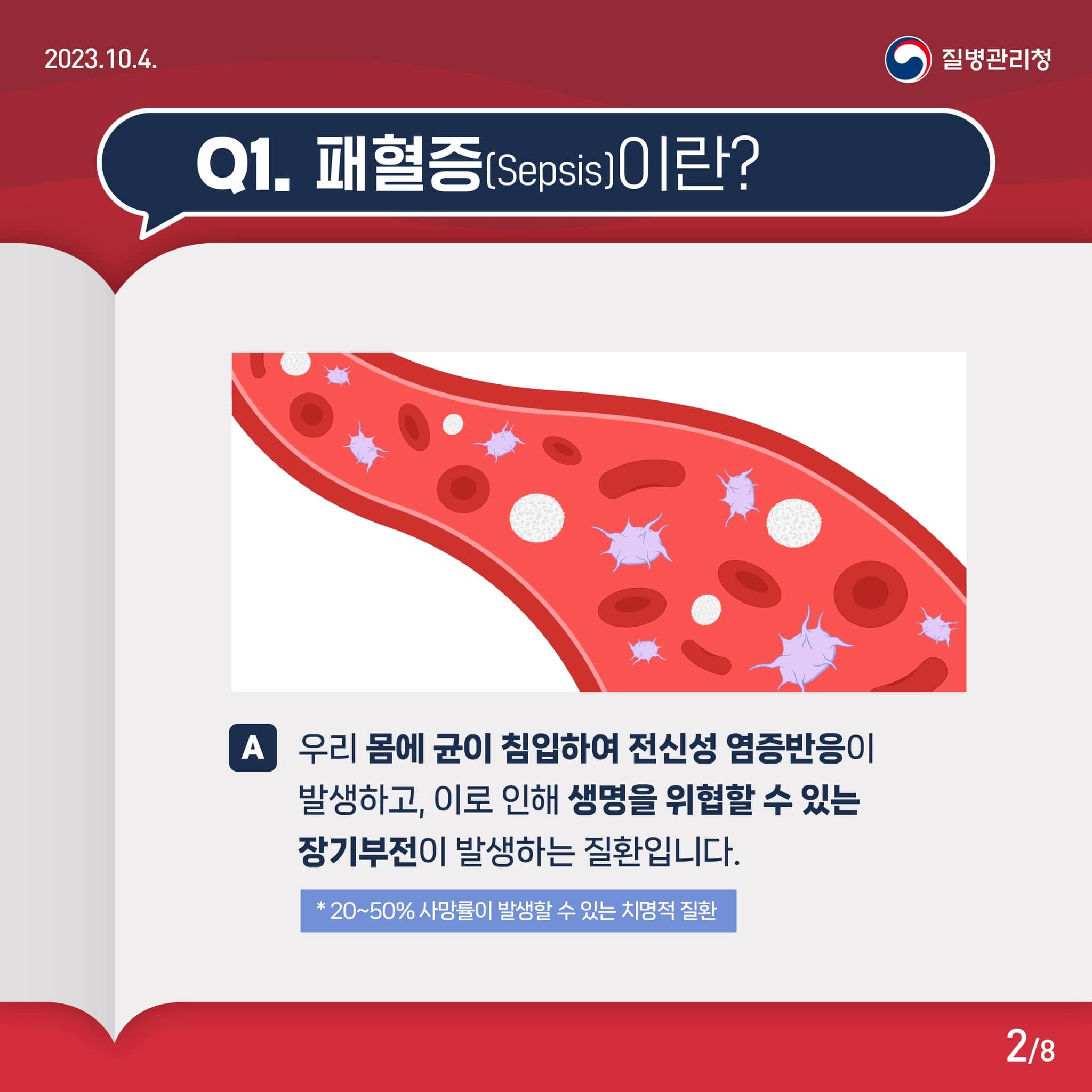 Q&A로 알아보는 패혈증 바로 알기!