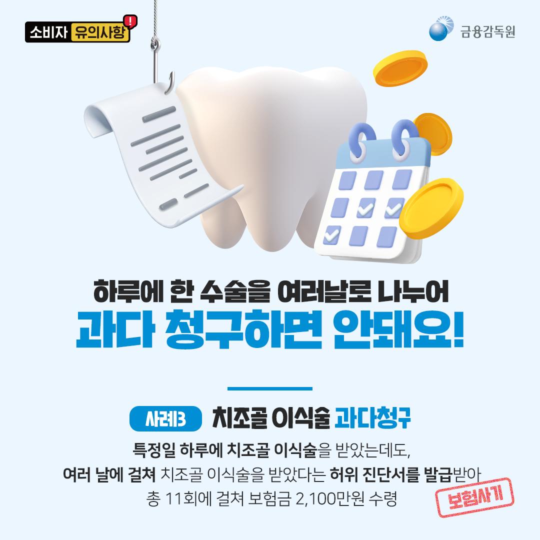 치과 보험에도 사기가 있다고? 치과질환 보험사기 방지법은?