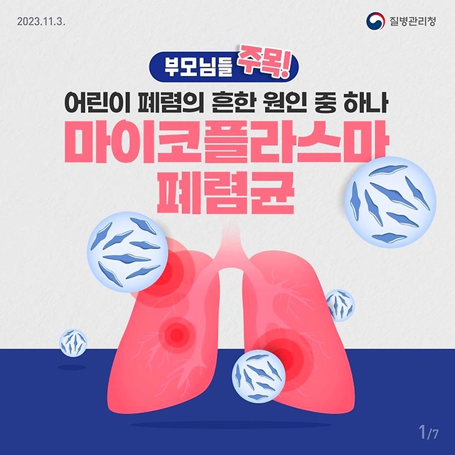 어린이 폐렴의 원인 중 하나 마이코플라스마 폐렴균 감염증