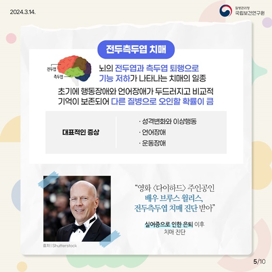 치매에는 나이가 없다? 젊은 세대도 안심할 수 없는 조발성 치매!