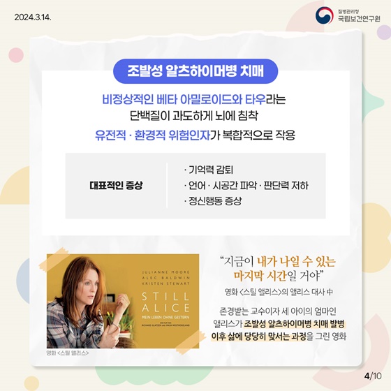 치매에는 나이가 없다？  젊은 세대도 안심할 수 없는 조발성 치매!