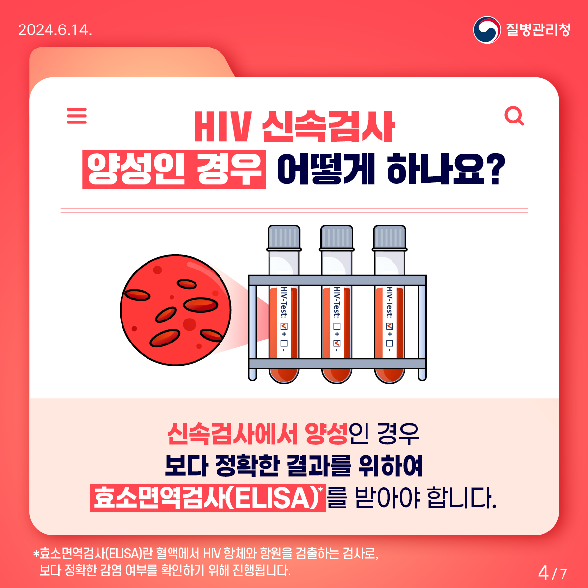 HIV 감염의 신속한 확인은 “신속검사”로!