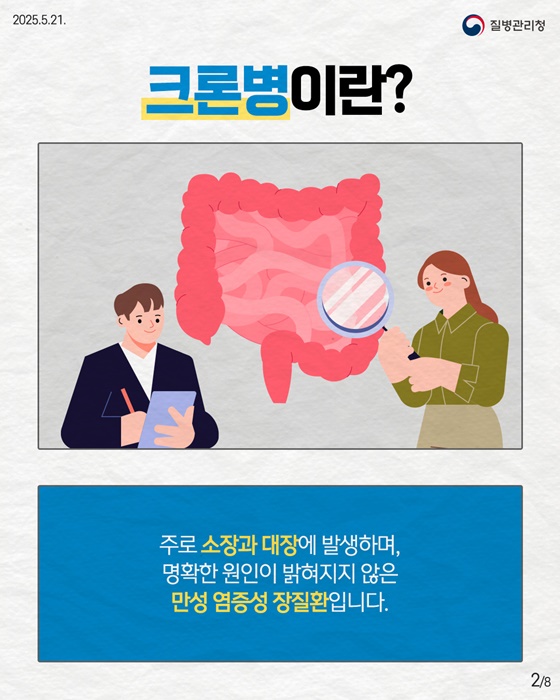 만성 염증성 장질환 크론병