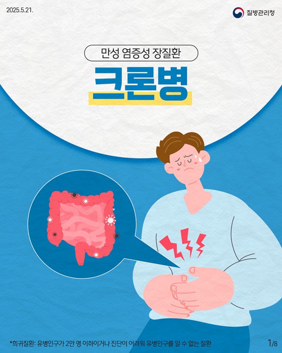 만성 염증성 장질환 크론병