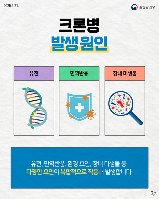 만성 염증성 장질환 크론병