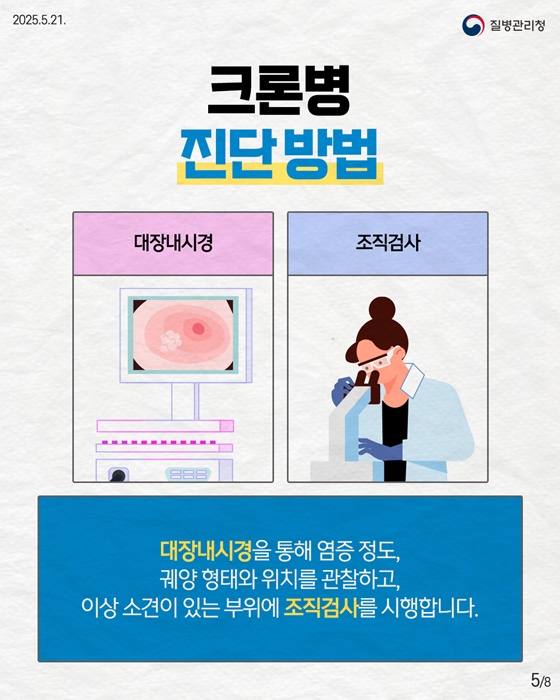 만성 염증성 장질환 크론병