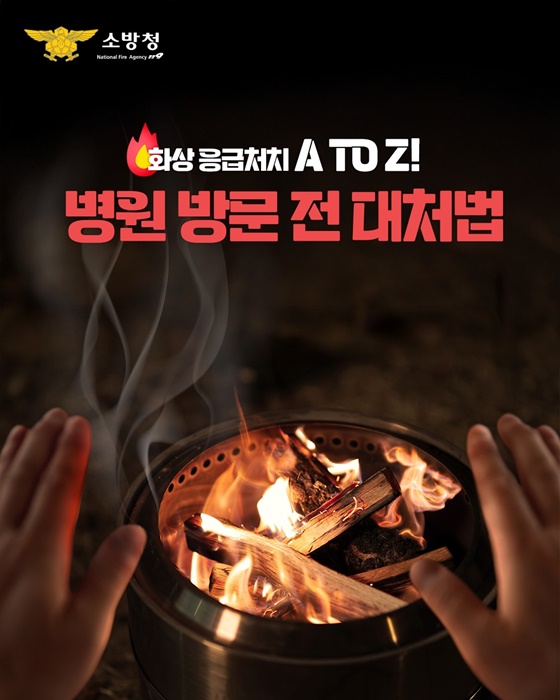 화상 응급처치, 병원 방문 전 대처법