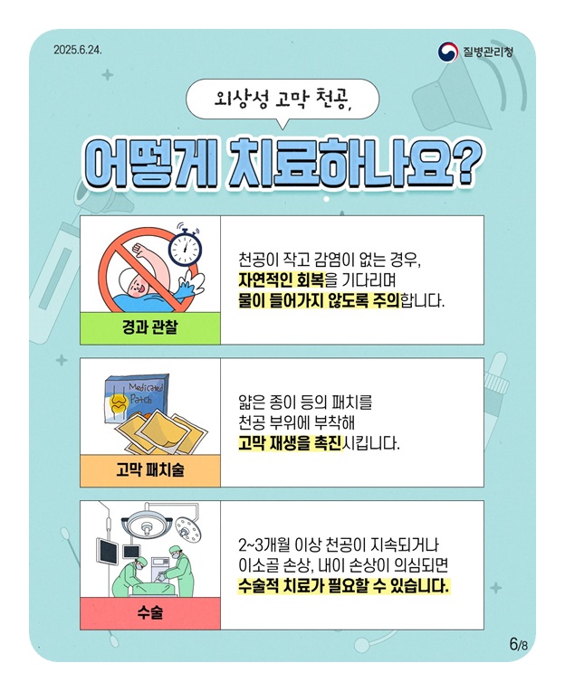 건강한 귀, 이렇게 관리해요