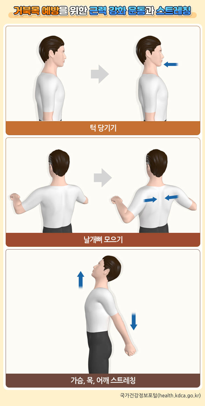 거북목 예방을 위한 근력 강화 운동과 스트레칭