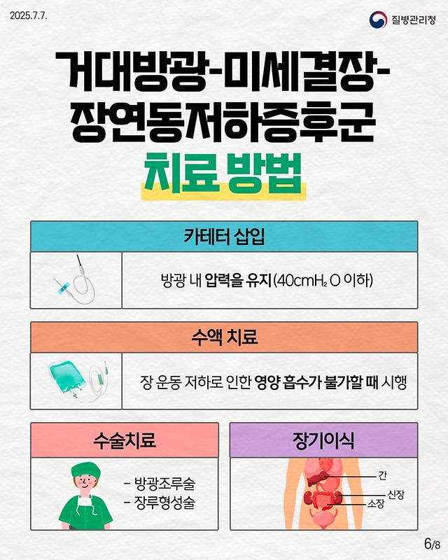 선천성 유전자 돌연변이 희귀질환 거대방광-미세결장-장연동저하증후군