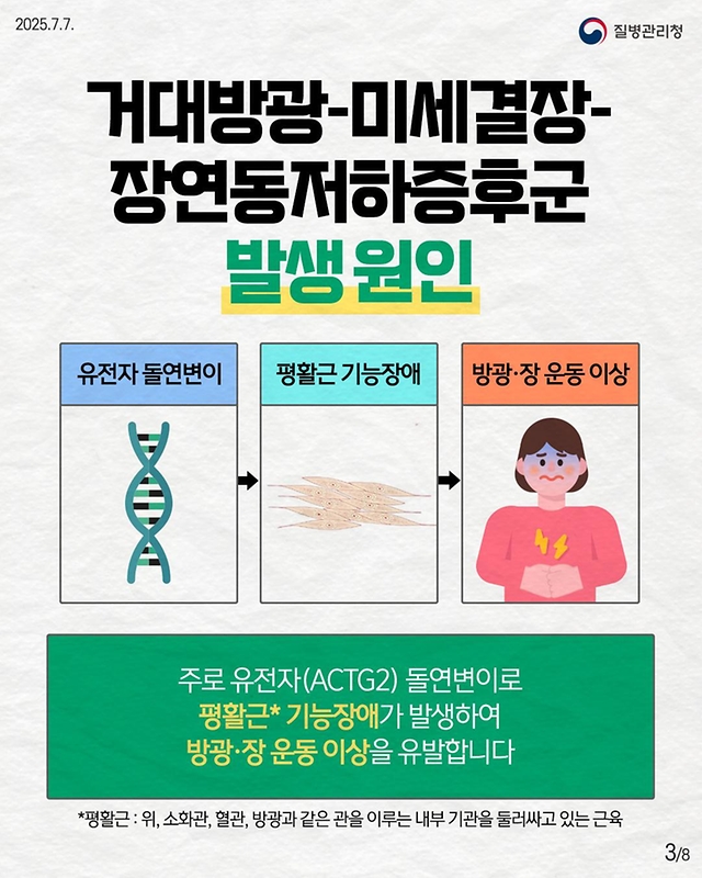 선천성 유전자 돌연변이 희귀질환 거대방광-미세결장-장연동저하증후군