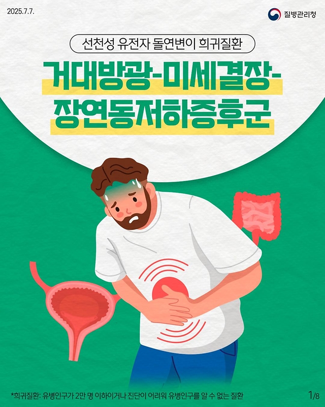 선천성 유전자 돌연변이 희귀질환 거대방광-미세결장-장연동저하증후군