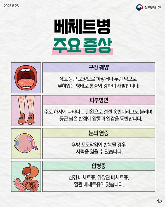 자가면역질환 베체트병