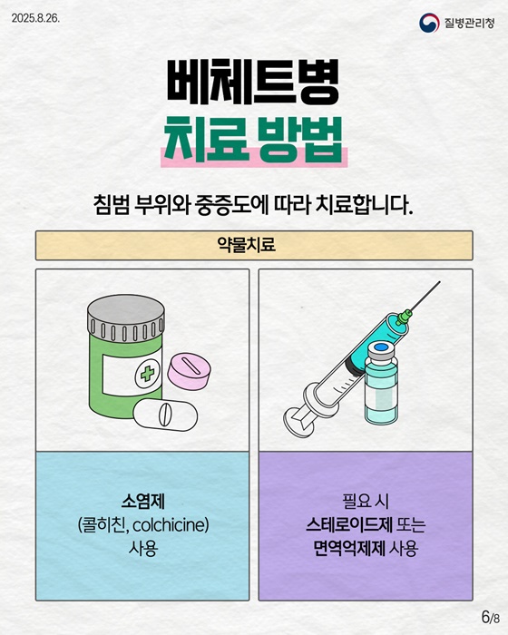 자가면역질환 베체트병