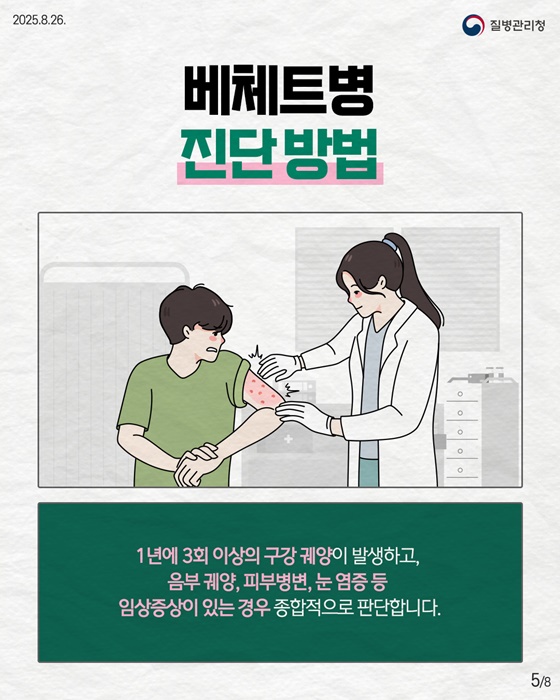 자가면역질환 베체트병